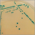 Chromogenic ß-D-Ribofuranoside Substrates