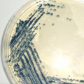 5-Bromo-3-indolyl Blue Substrates